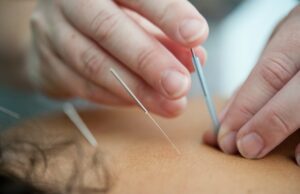 formation acupuncture